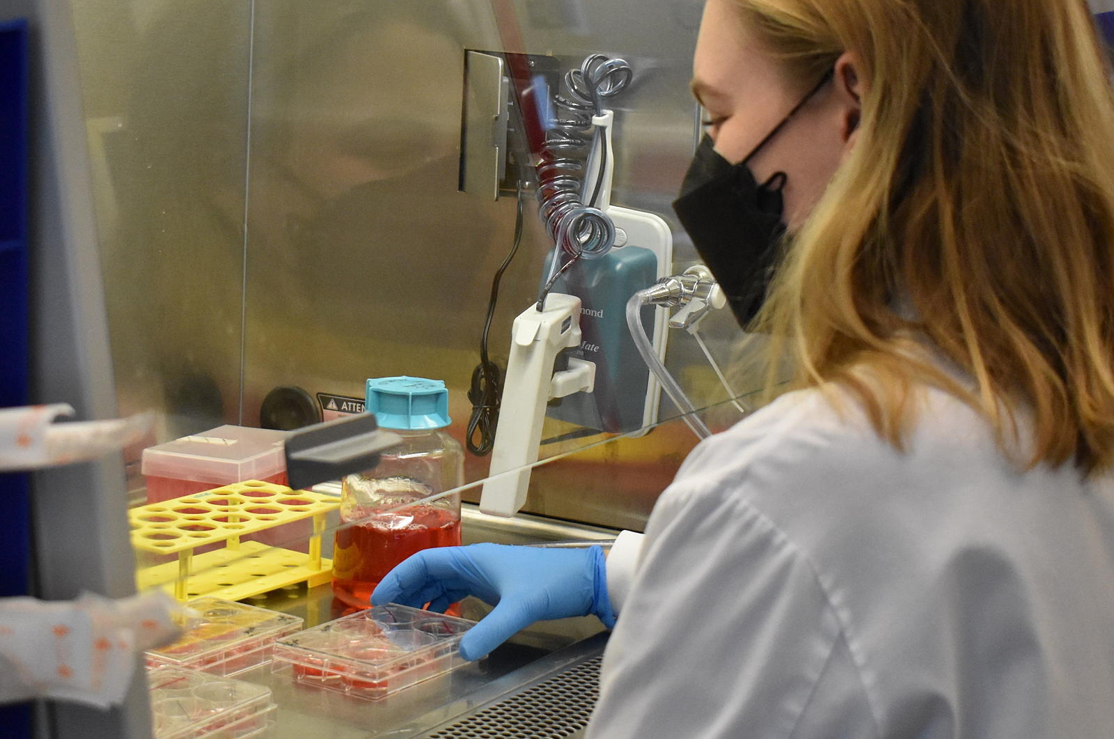 A postdoctoral scientist develops miniature human brain tissue in a dish.