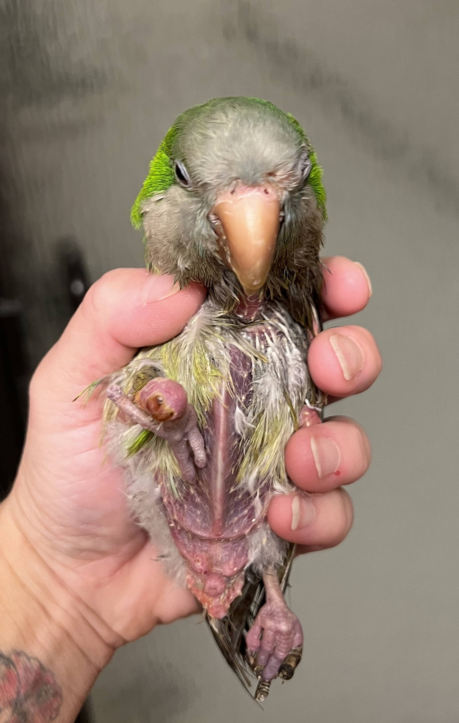 2 months later! The early pictures might be too graphic for some people.